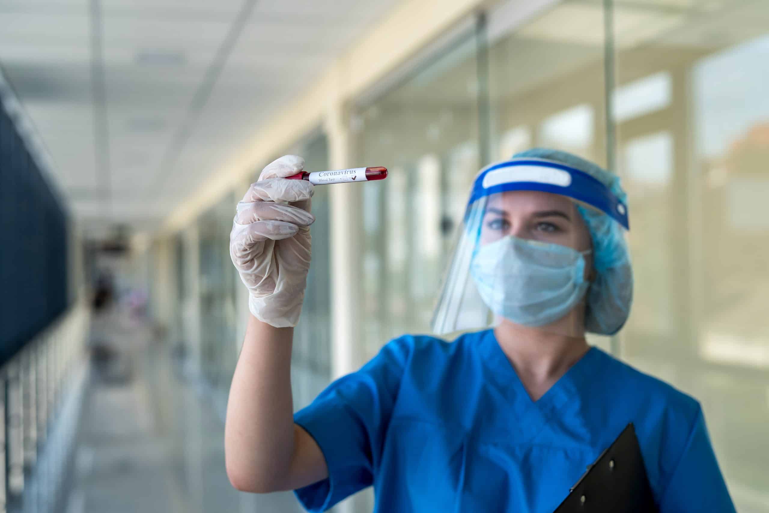 Intern nurse with a face shield showing at positive test tube on covid 19 in hospital